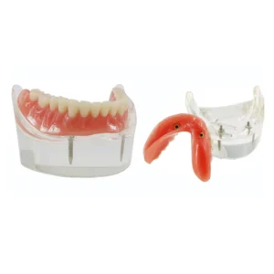 2 Implant Model